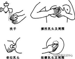 急性化膿性乳腺炎該如何預(yù)防